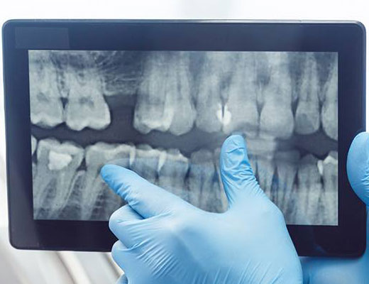 CBCT 3D X- Ray Technology